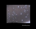 bacterial colonies